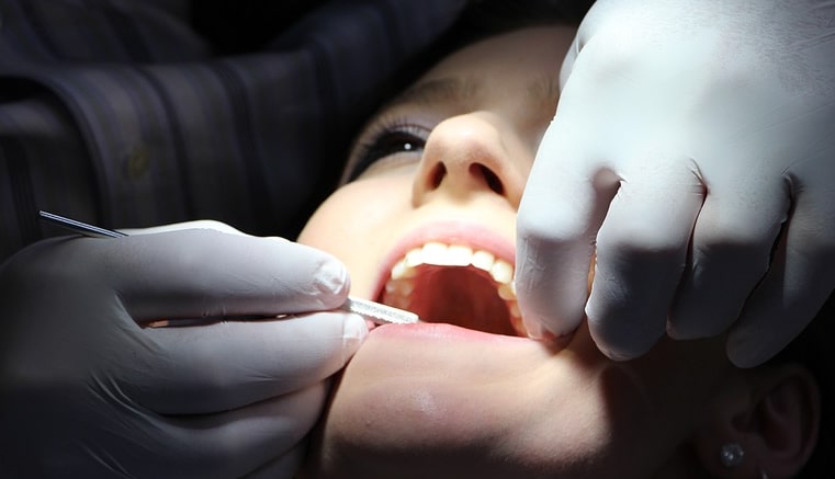 las interenciones dentales