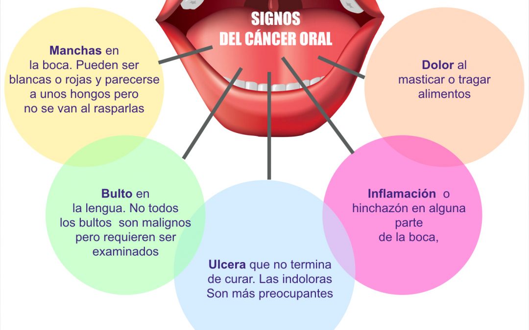 La prevención y el diagnóstico son indispensables contra el cáncer oral