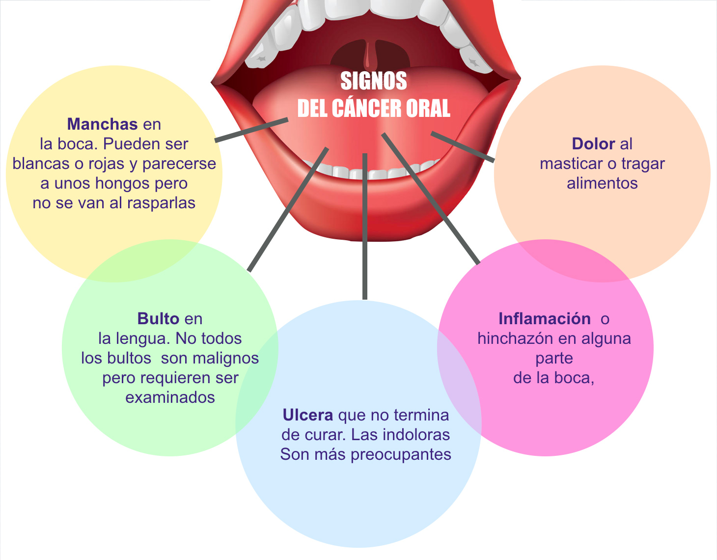 La prevención y el diagnóstico son indispensables contra el cáncer oral