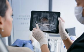 Mis dientes están agrietados